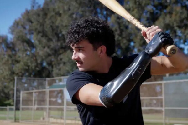 1 bionic hand brings baseball star back to the field