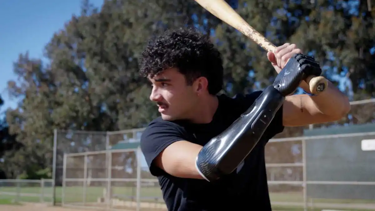1 bionic hand brings baseball star back to the field