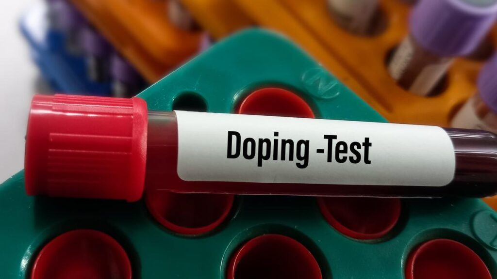 dopingtest