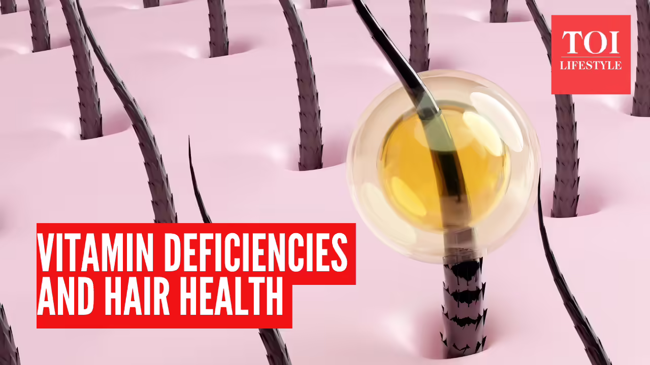 msid 126252137imgsize 591467.cms