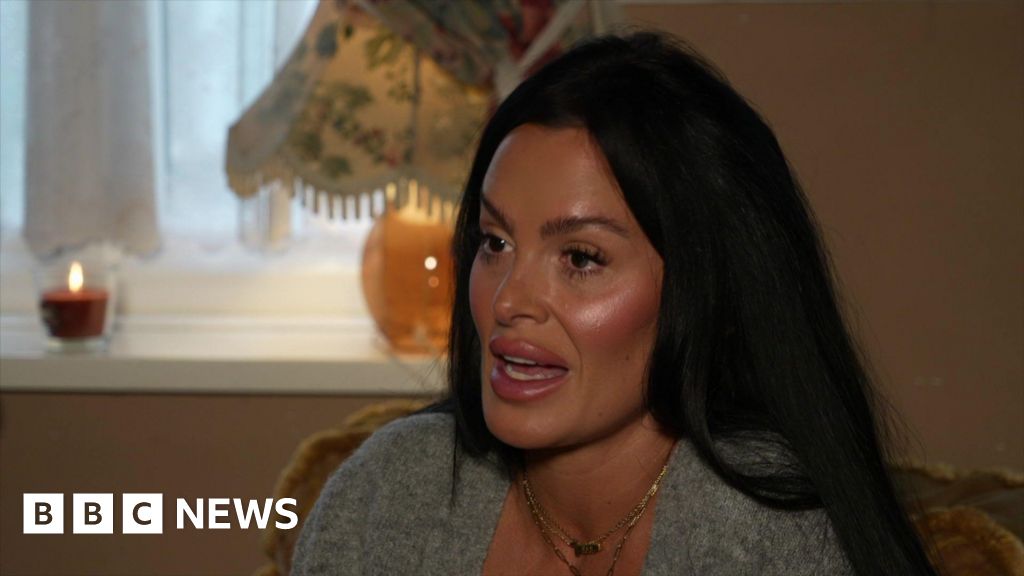 Woman's regret over botched Brazilian butt lift 1 395ce760 101a 11f1 9b57 6d6f22fc2adf.jpg